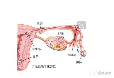 子宫卵巢保养的好处与功效，子宫和卵巢保养